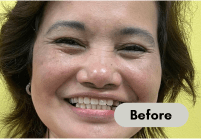 before-denture-care