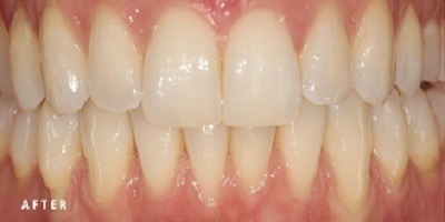 Before - New River Dental Enfield